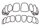 空隙歯列のイラスト